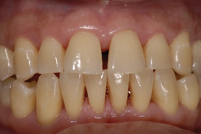 Figure 18