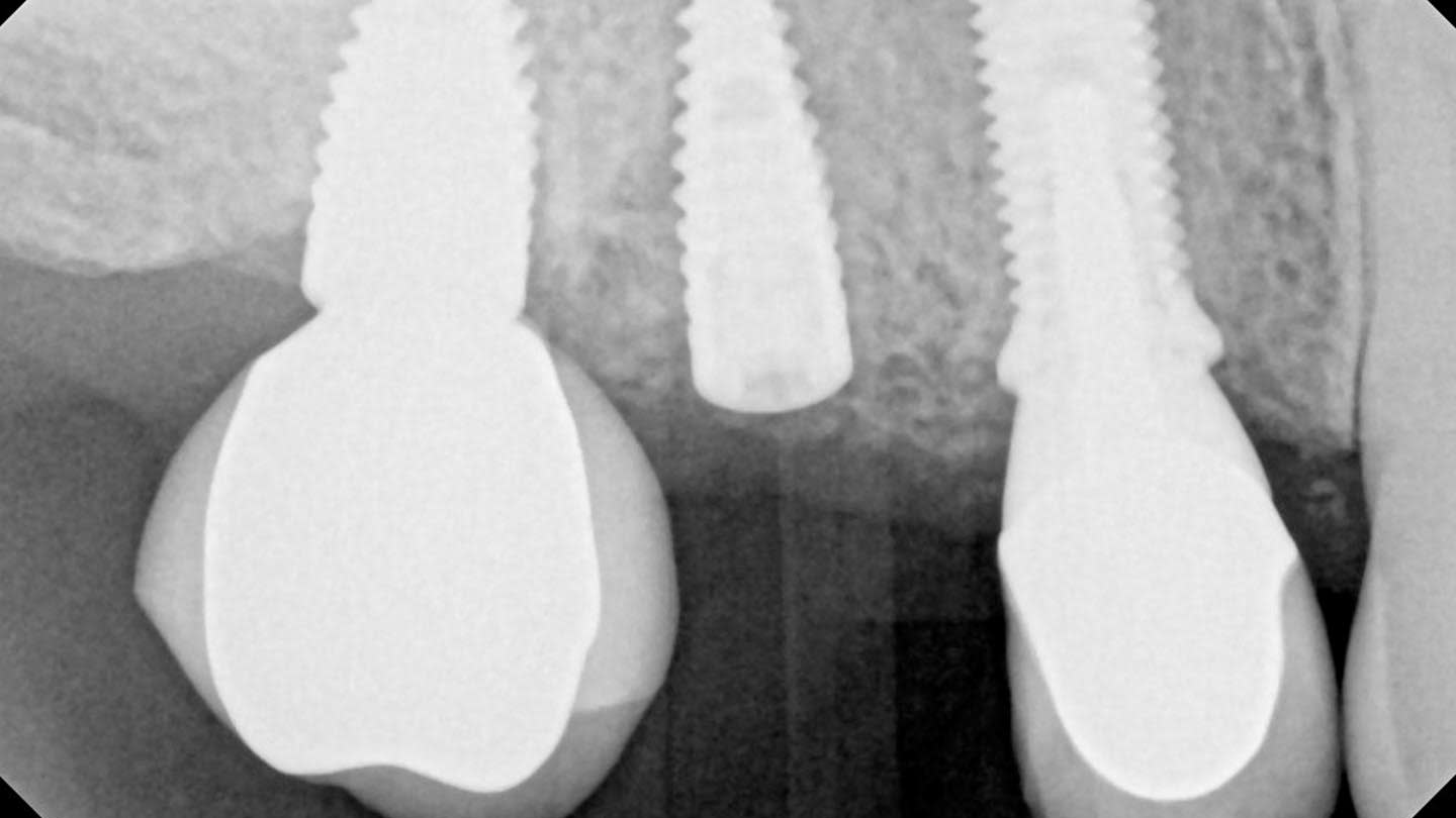Figure 19