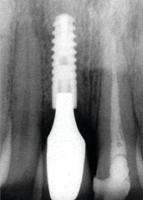 Figure 18