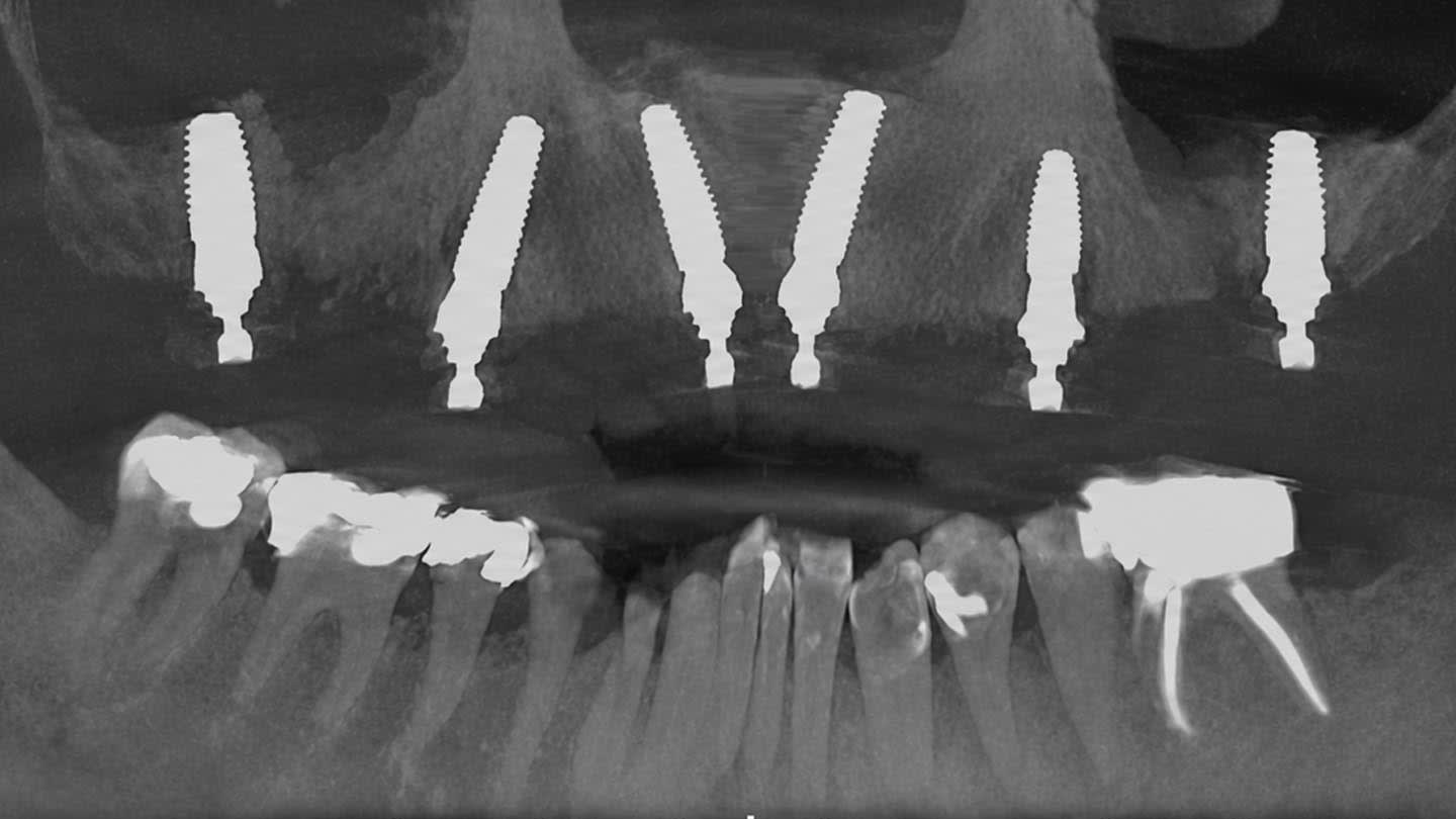 Figure 22