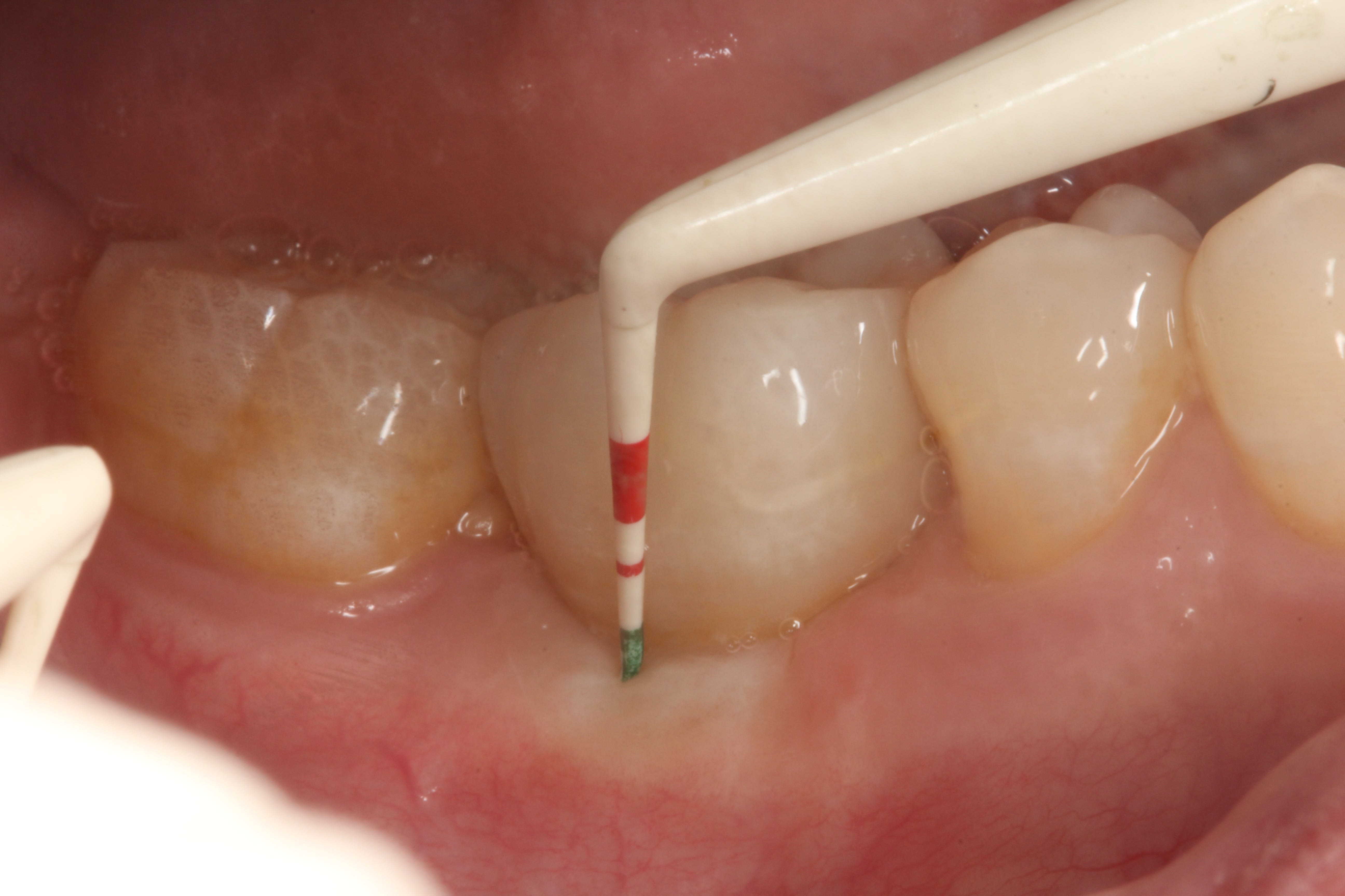 Figure 48