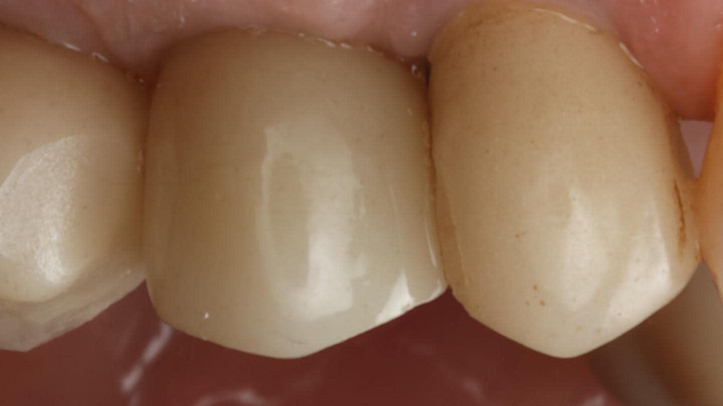 Figure 24