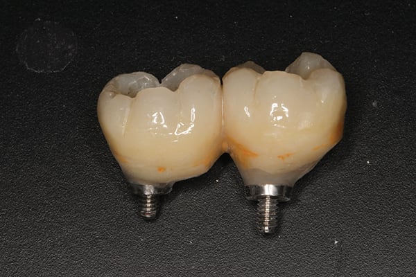 Figure 21