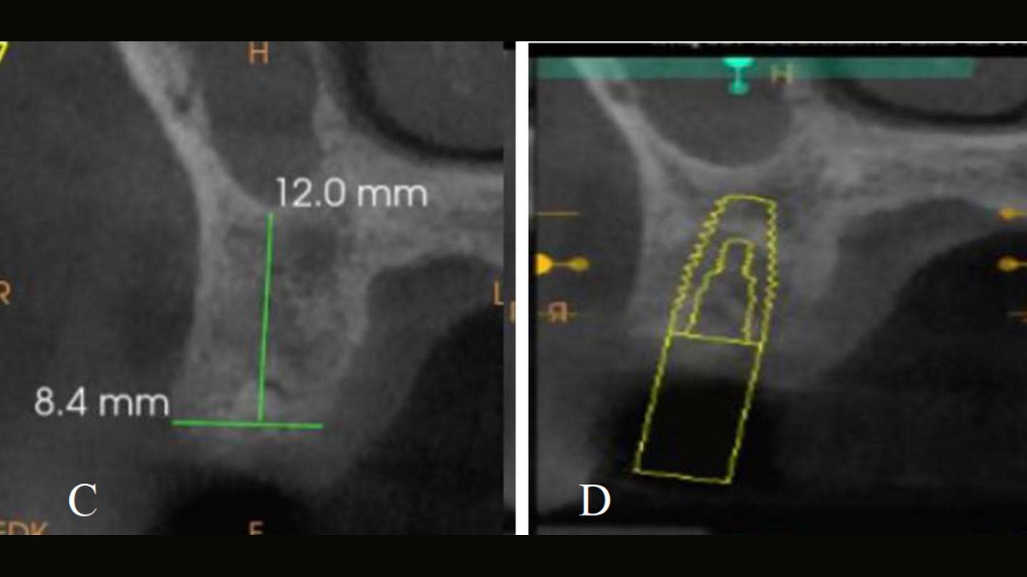 Figure 12