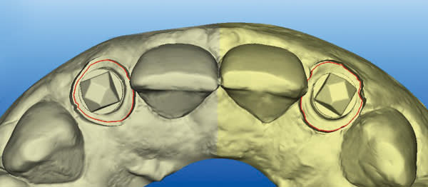 Figure 20