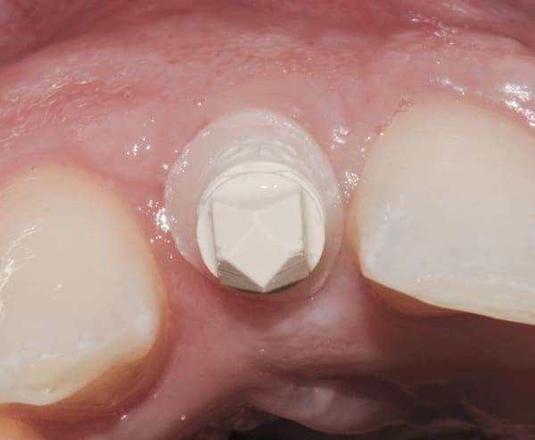 Figure 16