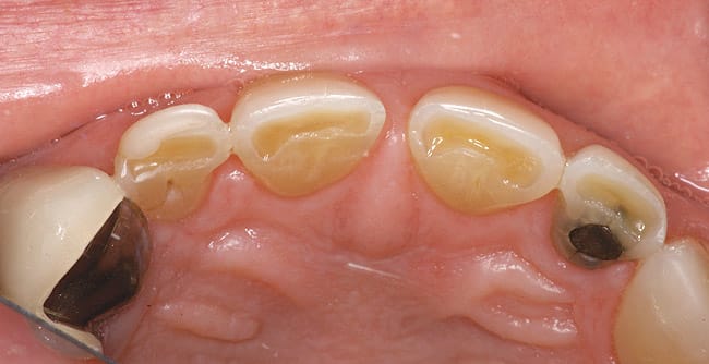 Figure 6c