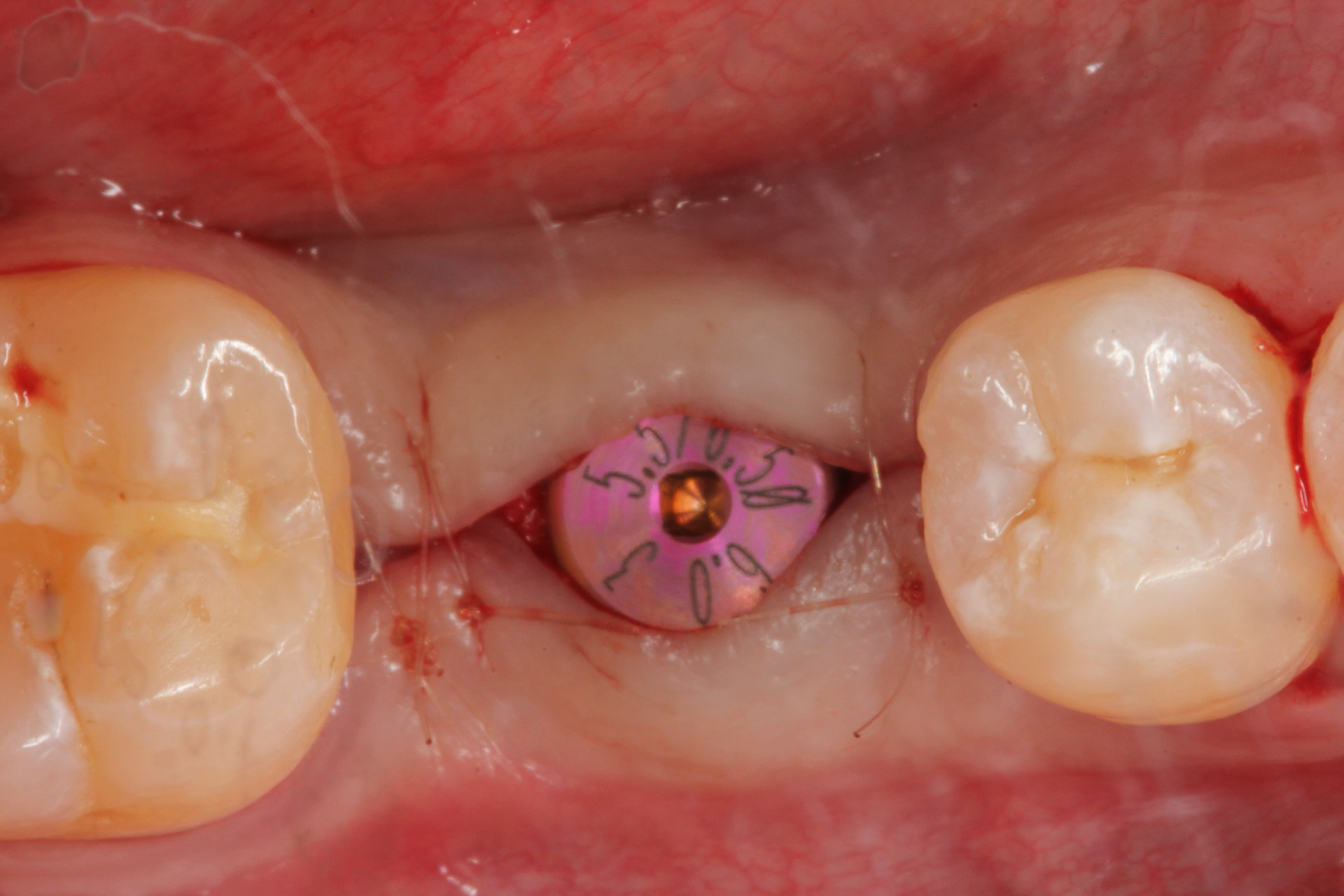 Figure 43