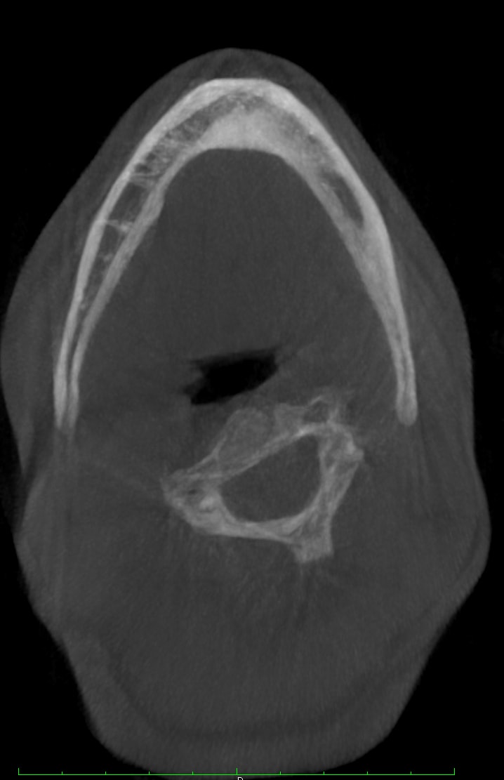 Figure 36