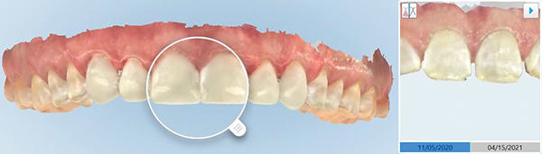Fig 10