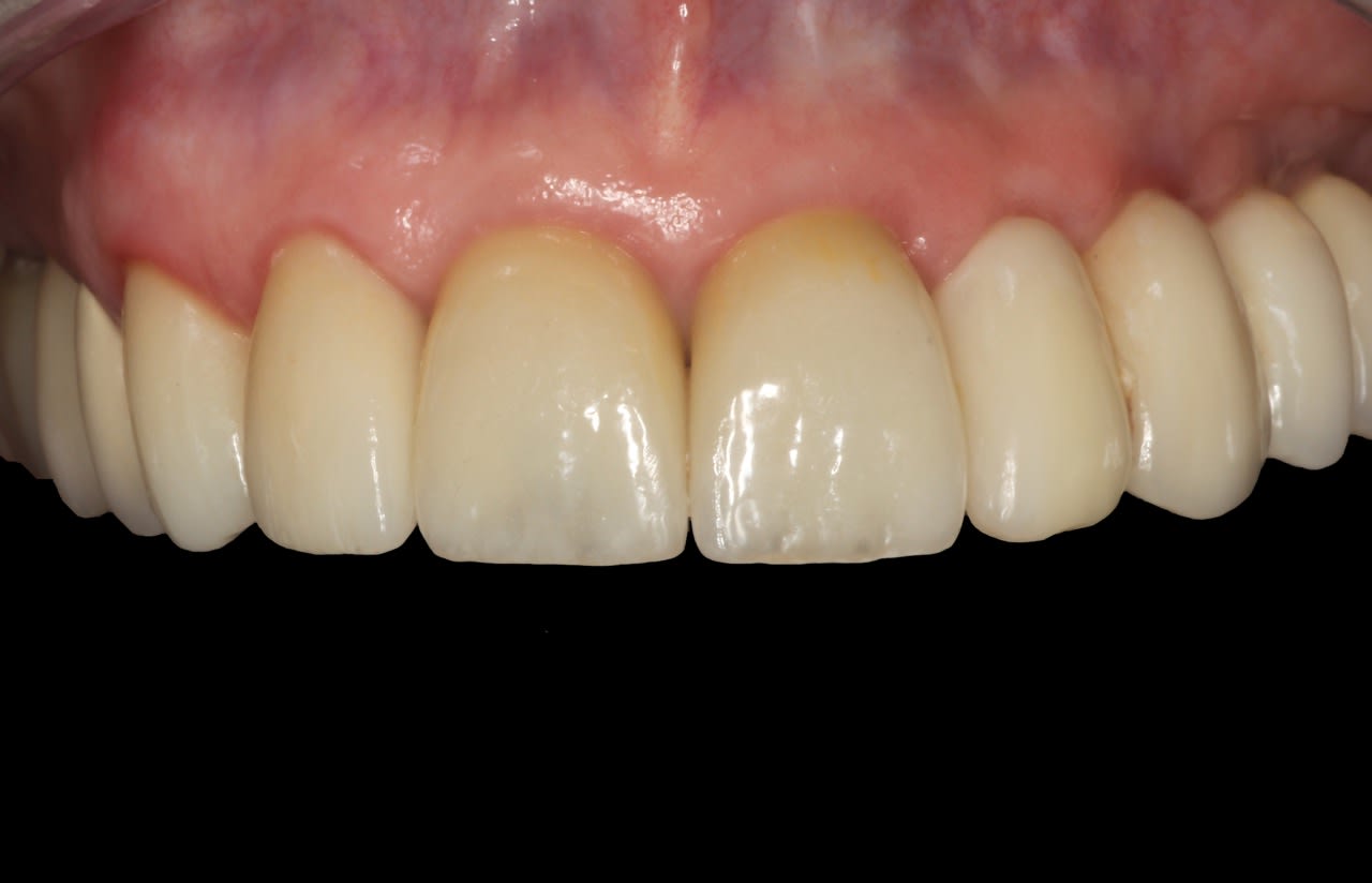 Figure 29