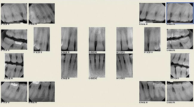 Figure 14