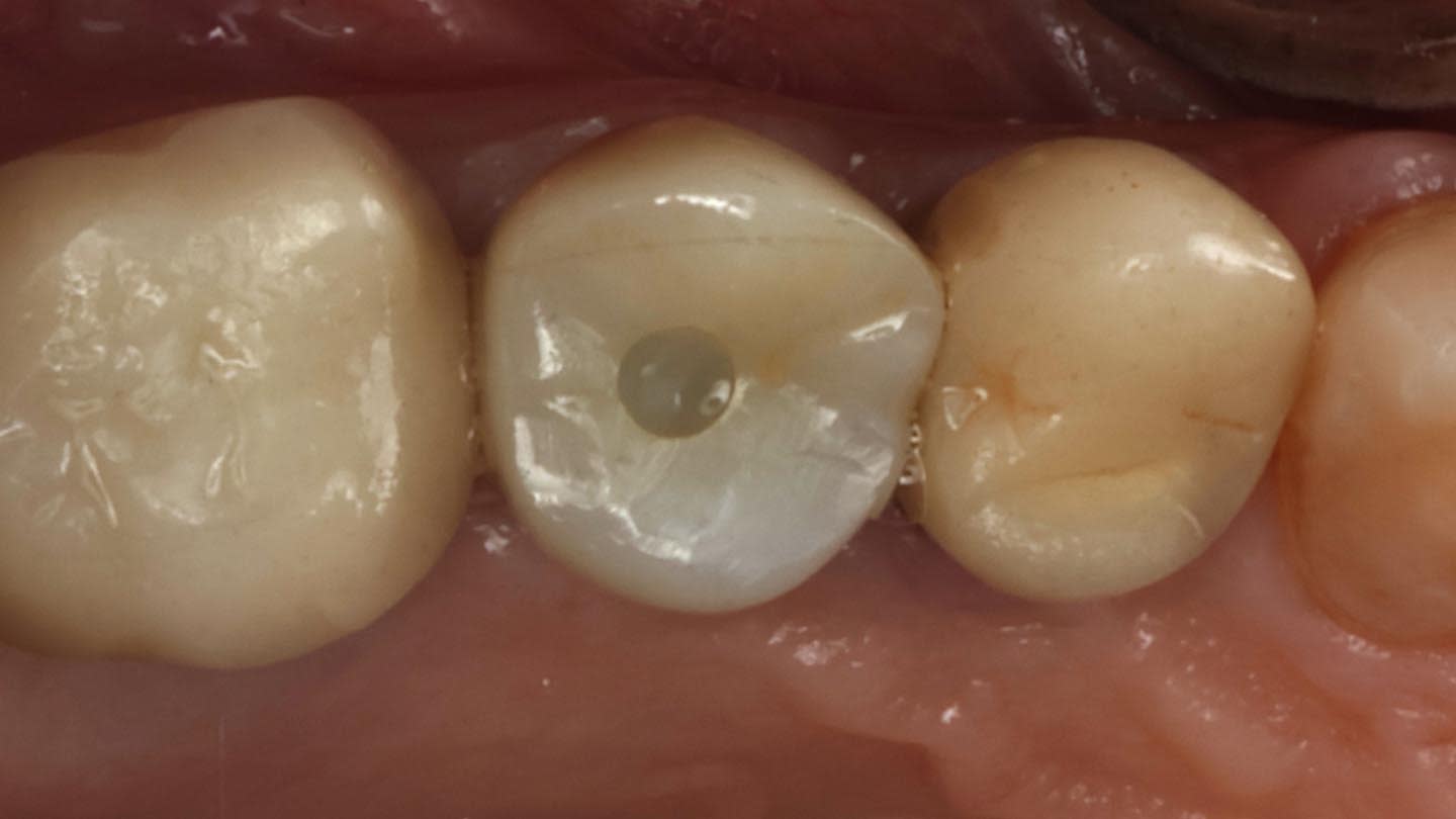 Figure 25