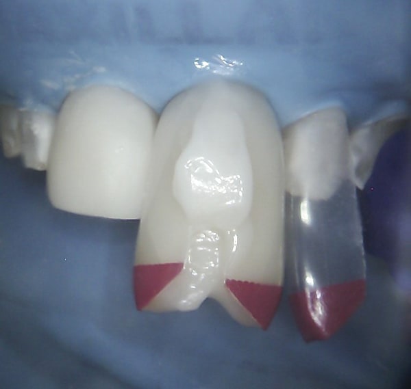 Fig 6