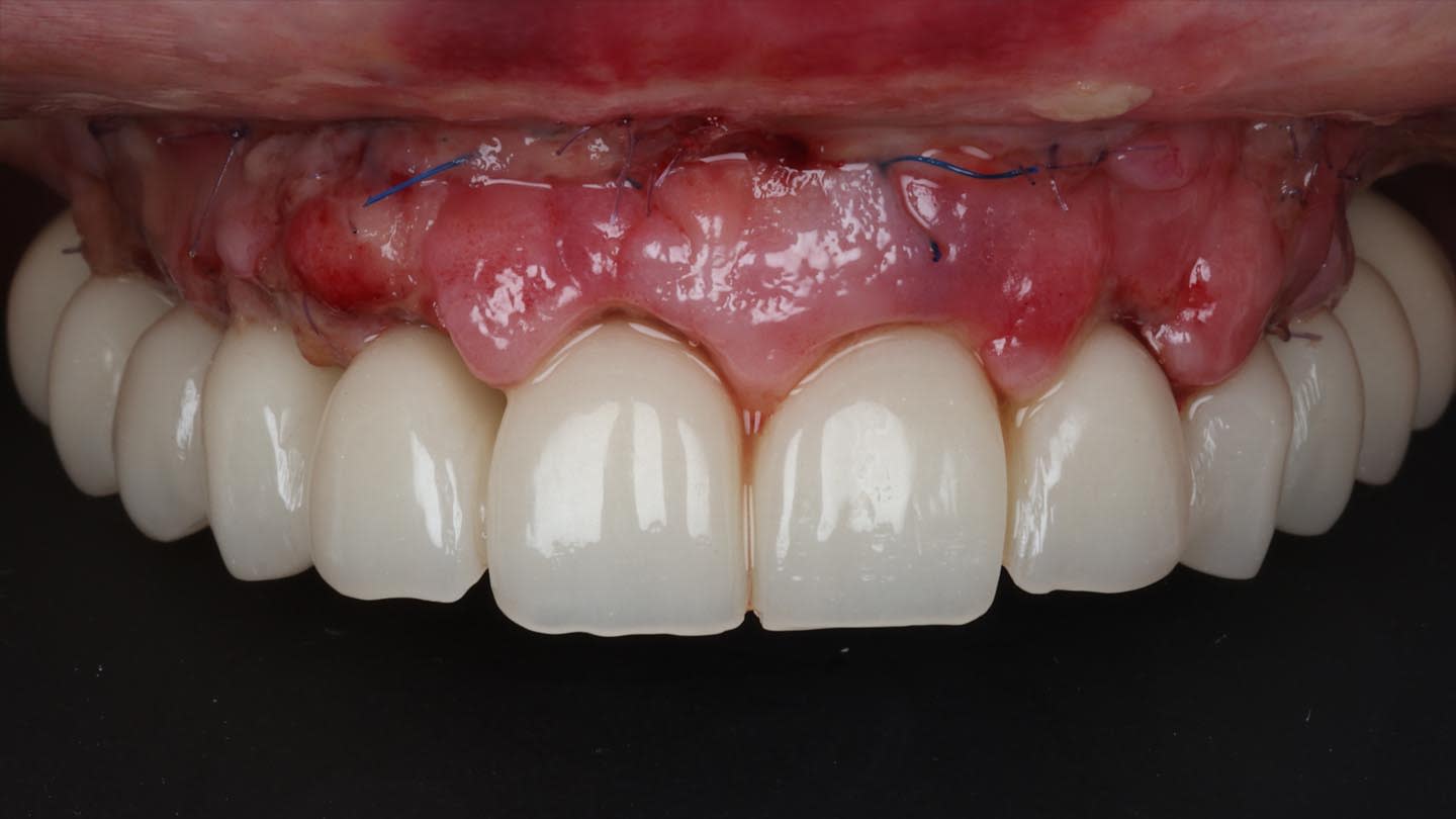 Figure 19