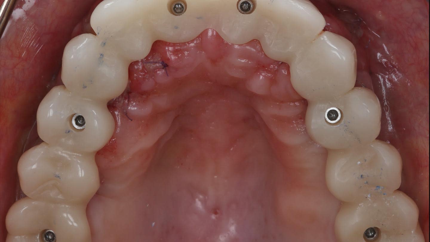 Figure 20