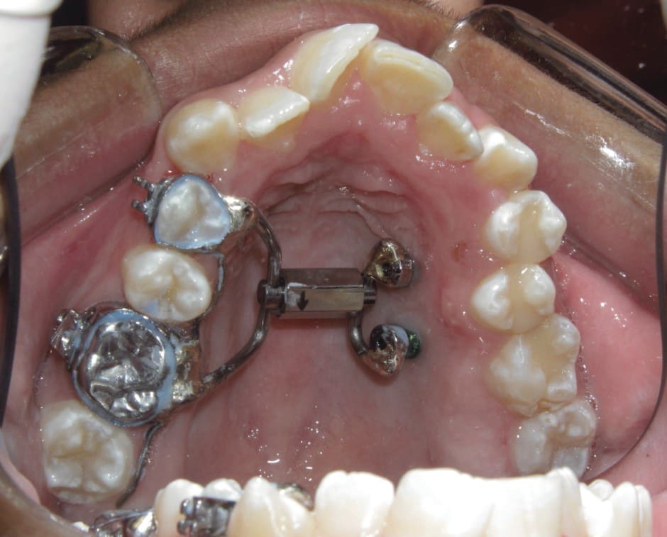 Figure 24