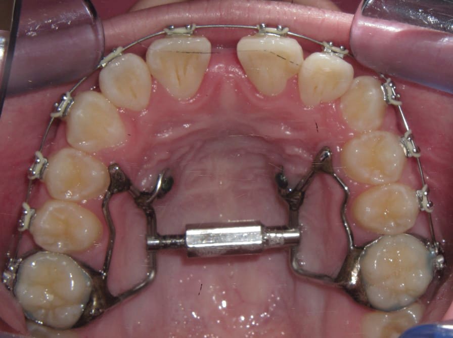 Figure 21