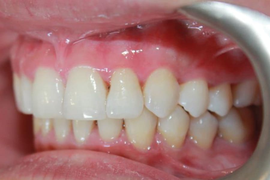 Figure 12