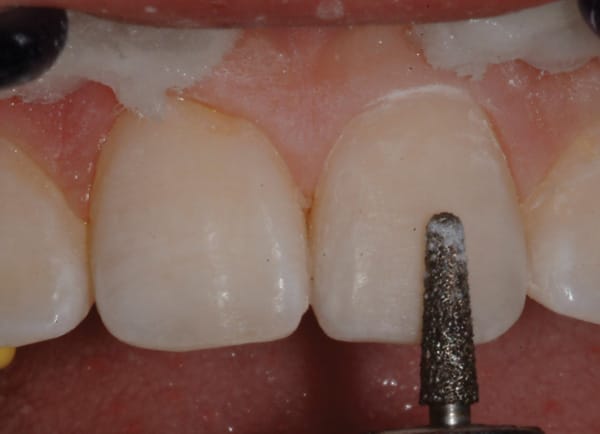 Figure 17