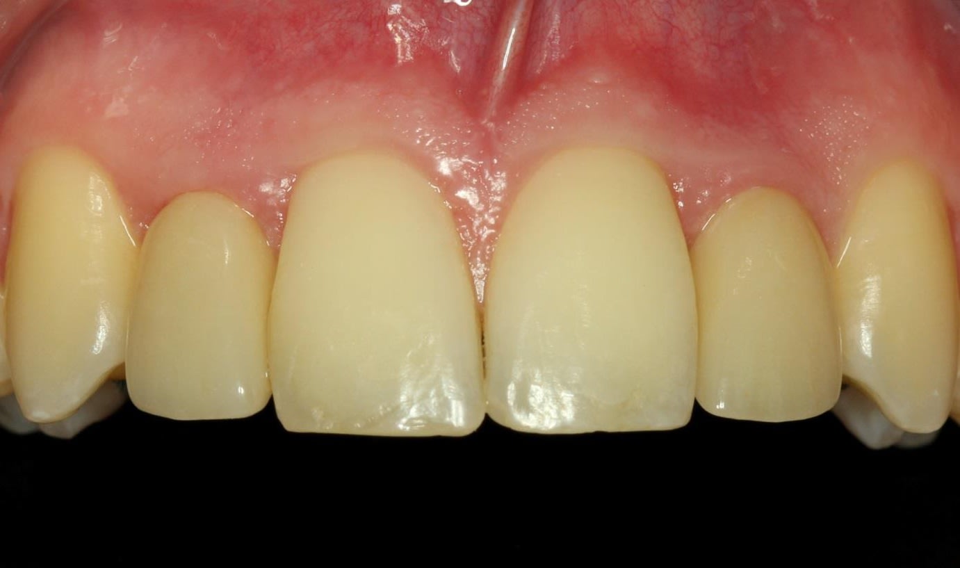 Figure 20.