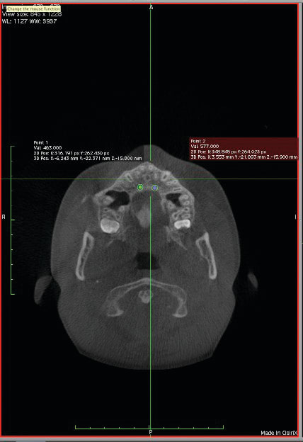 Figure 15
