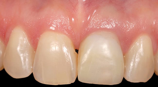 Figure 18
