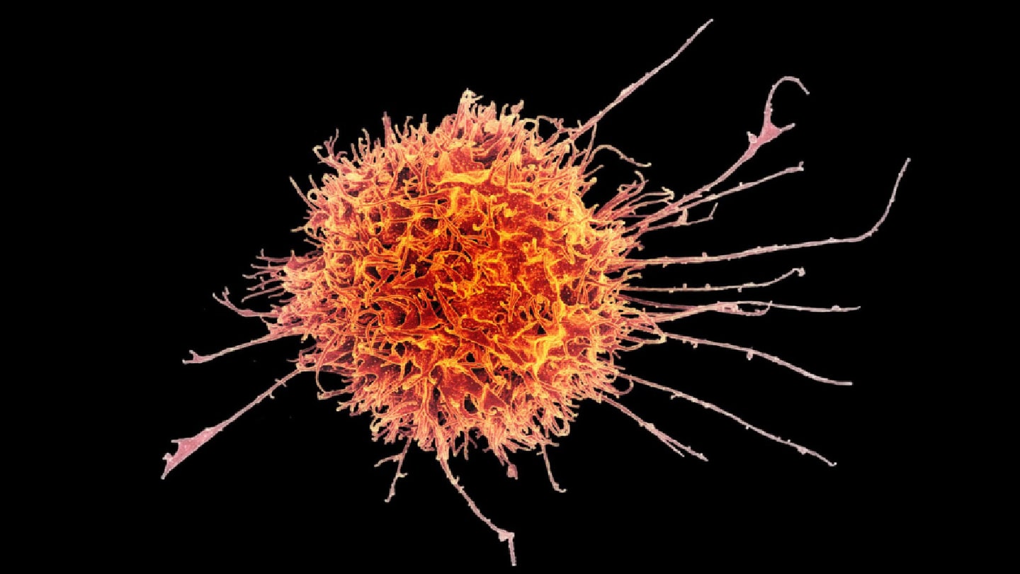 Tissue-Resident NK Cells Slow Solid Tumor Growth in Mice