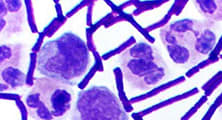 Antibiotic Action