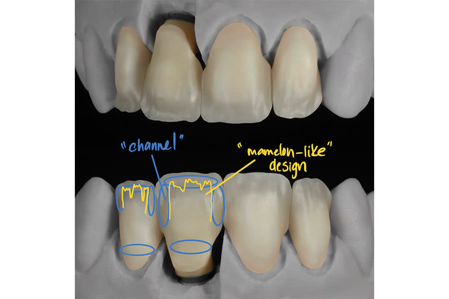 Figure 5