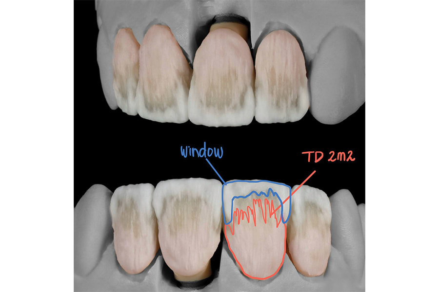 Figure 21