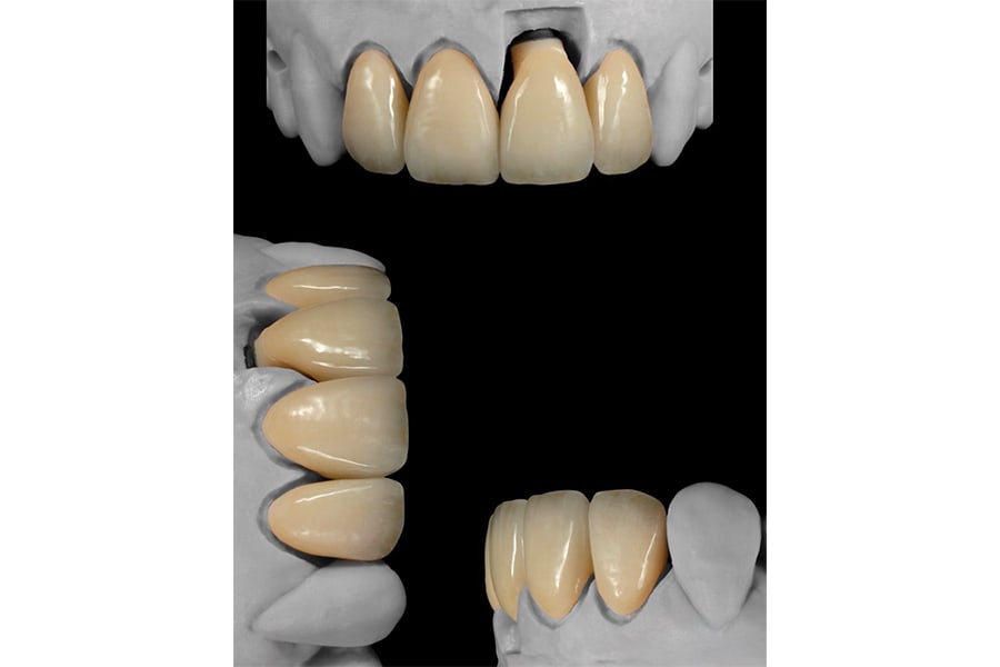 Figure 30