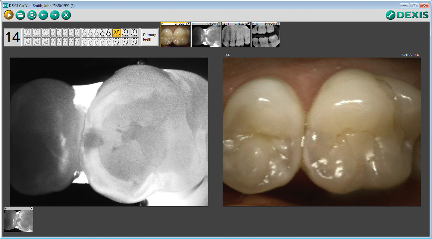Figure 2