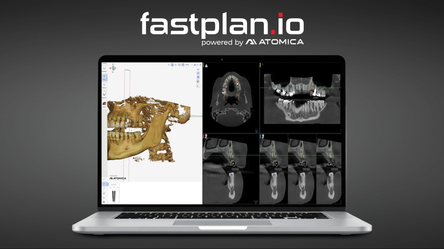 fastplan.io™ Implant Planning Solution