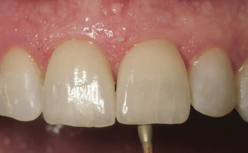 Figure 12