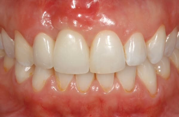 Figure 14