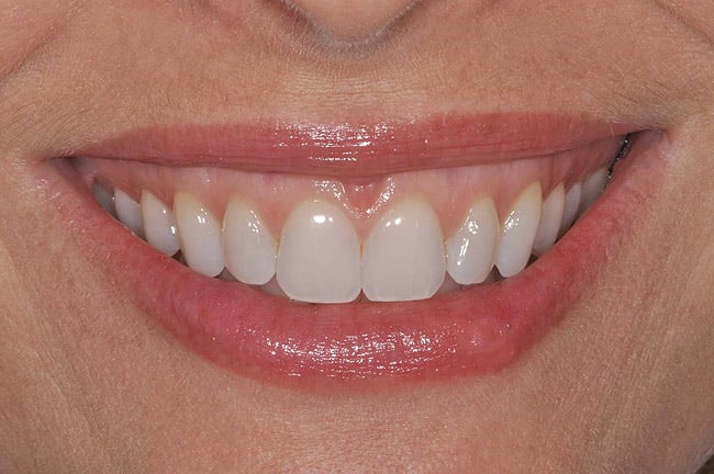 Figure 3d