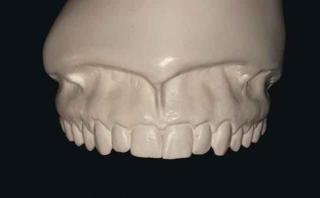 Figure 33