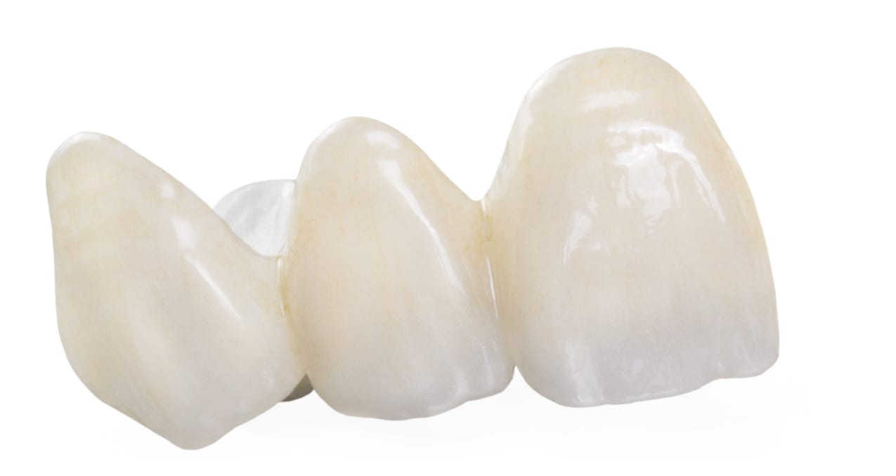 Figure 18