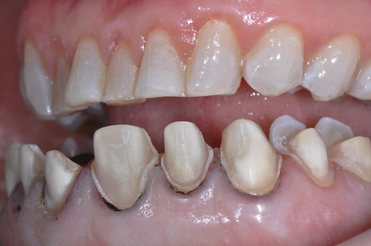 Figure 11