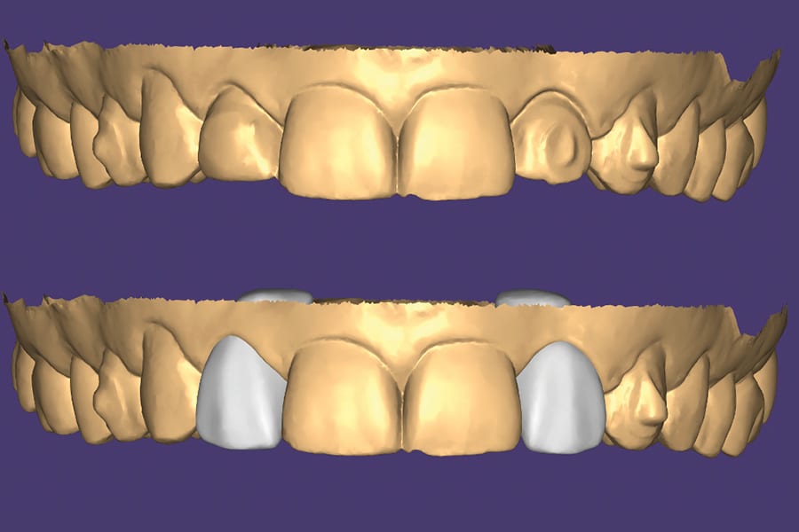 Fig. 4