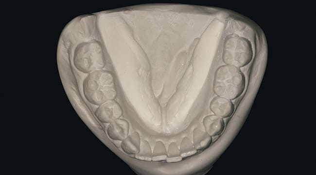 Figure 3c