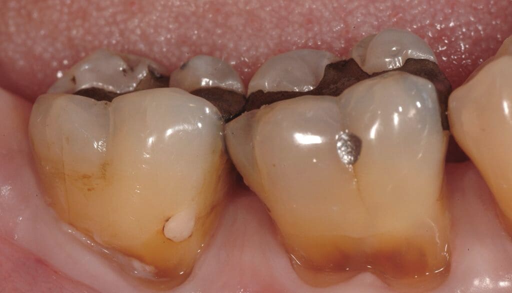 Figure 15