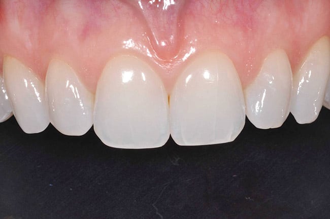 Figure 3m