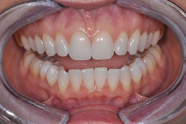 Figure 3j