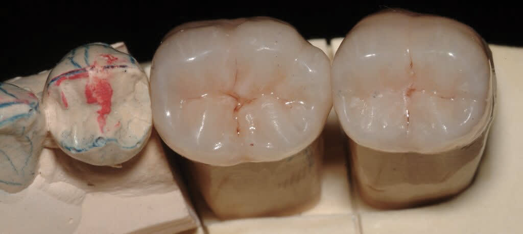 Figure 17