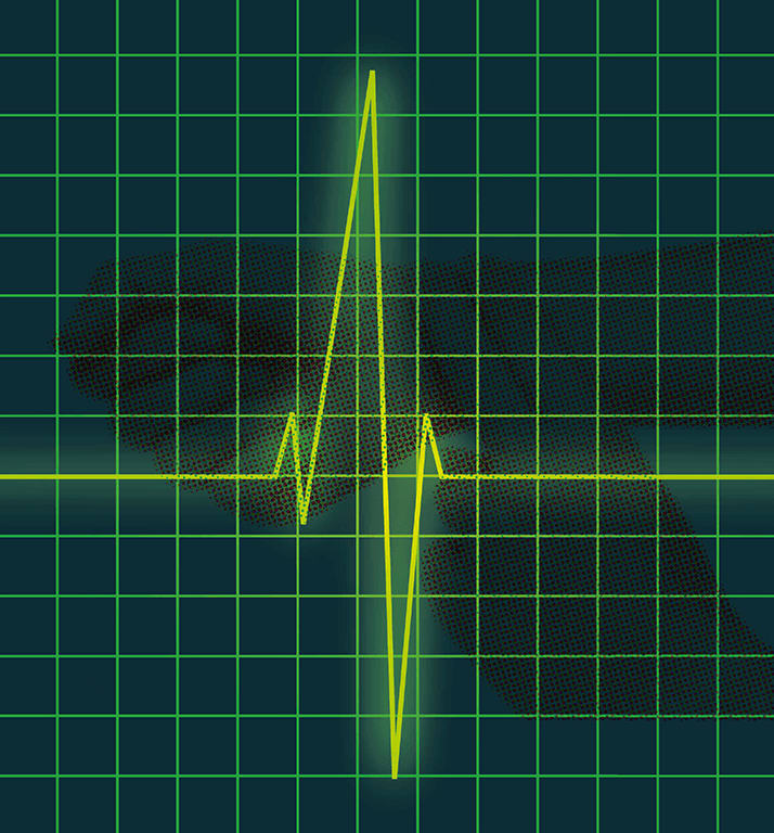 Keeping a Finger on the Biosimilar Pulse