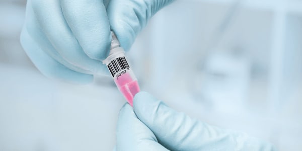 Serialization Blind Spots