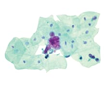 CellDetect® Innovative Staining Platform – The Power of Color for Early Cancer Detection