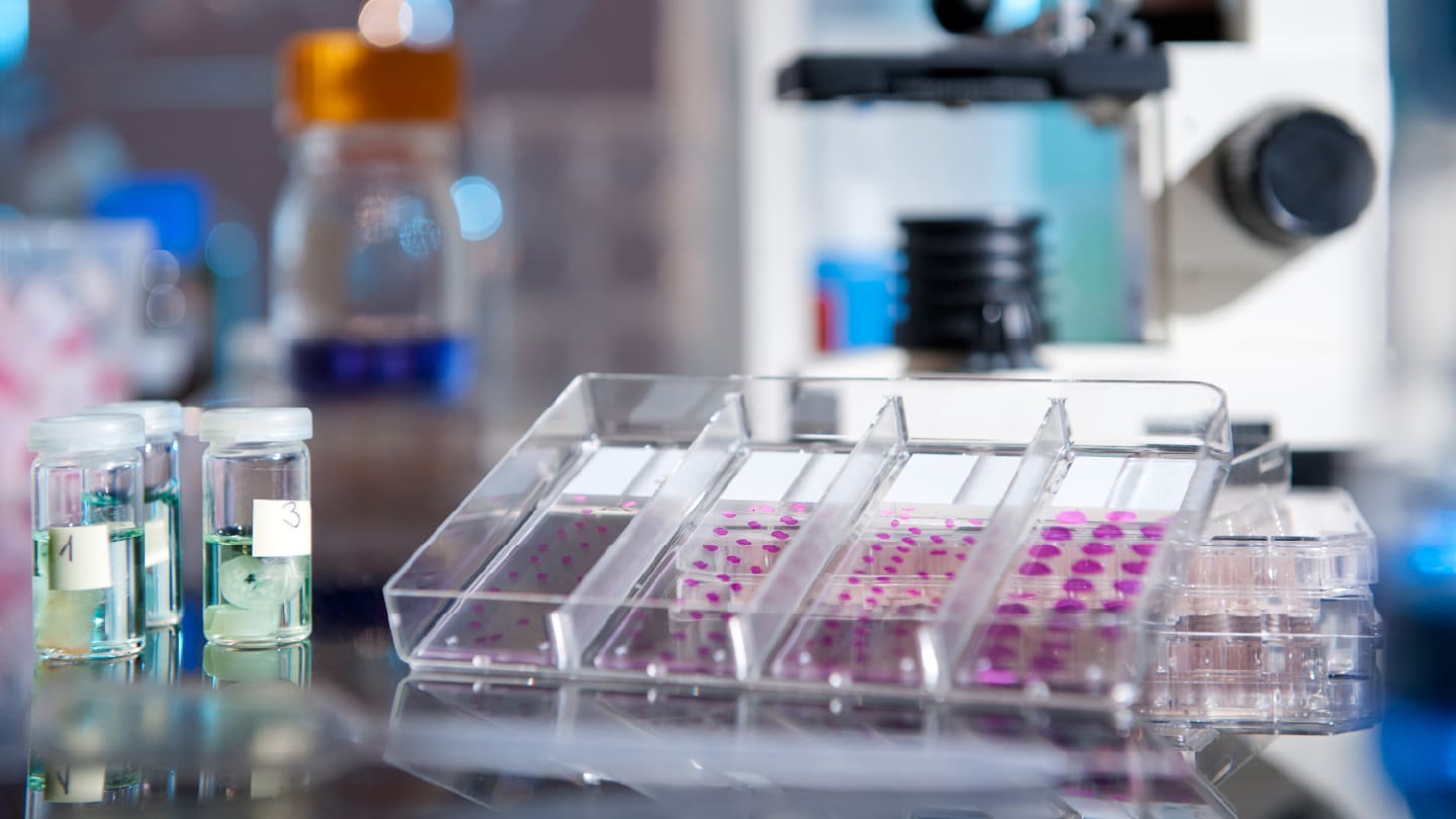 New Marker for Aggressive Prostate Cancer